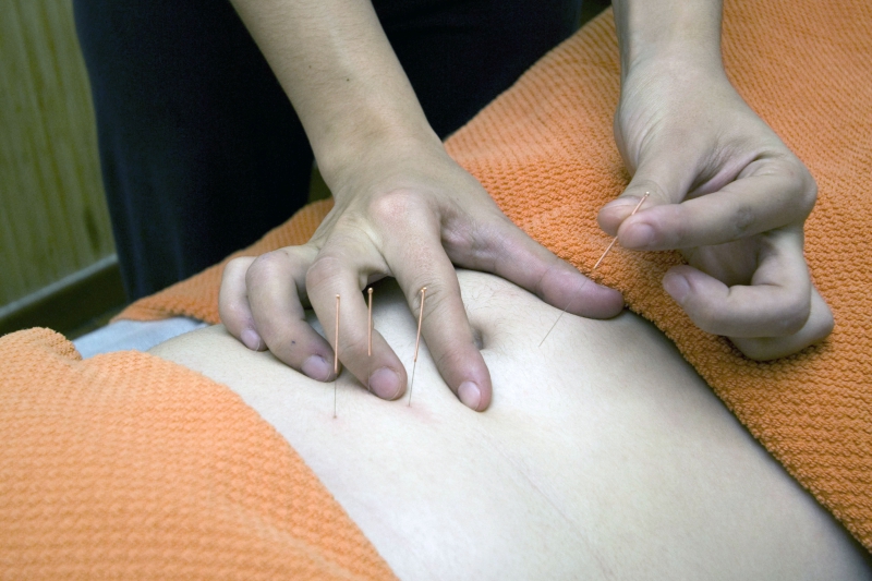 osteopathe-LA SEYNE SUR MER-min_acupuncture-4175625